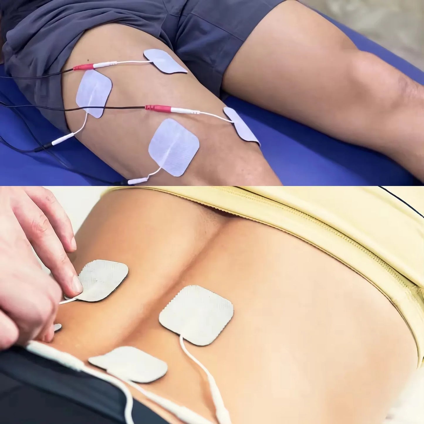 אלקטרומיוסטימולטור EzraMotion EMS/IFT
