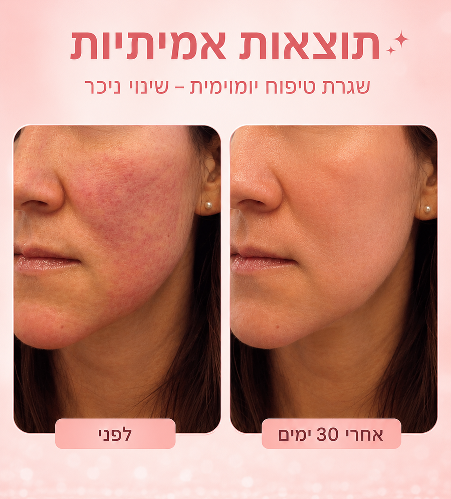 Kiyomi SkinLift™ 5D