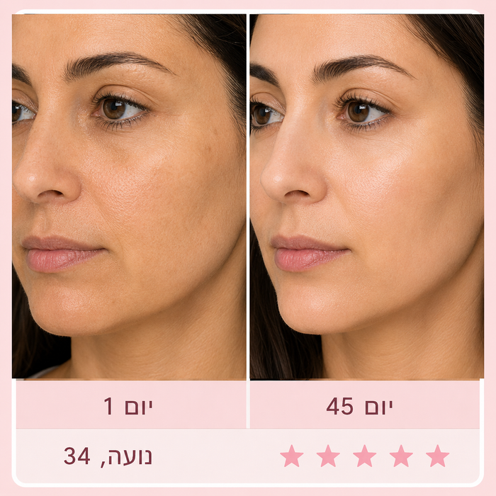 אחרי כמה שבועות של שימוש קבוע, שמתי לב שהעור נראה אחיד, רגוע וזוהר יותר. הטיפול עצמו נעים וקצר, והיה לי קל להתמיד בו בבית.